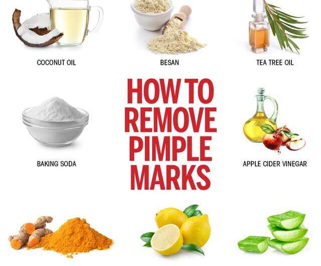 8 Ways to Remove Pimple Marks Naturally for Oily Skin