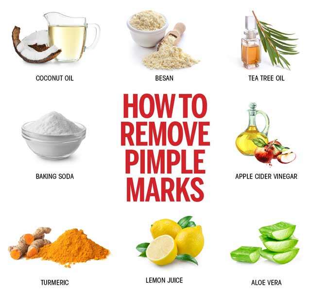 8 Ways to Remove Pimple Marks Naturally for Oily Skin