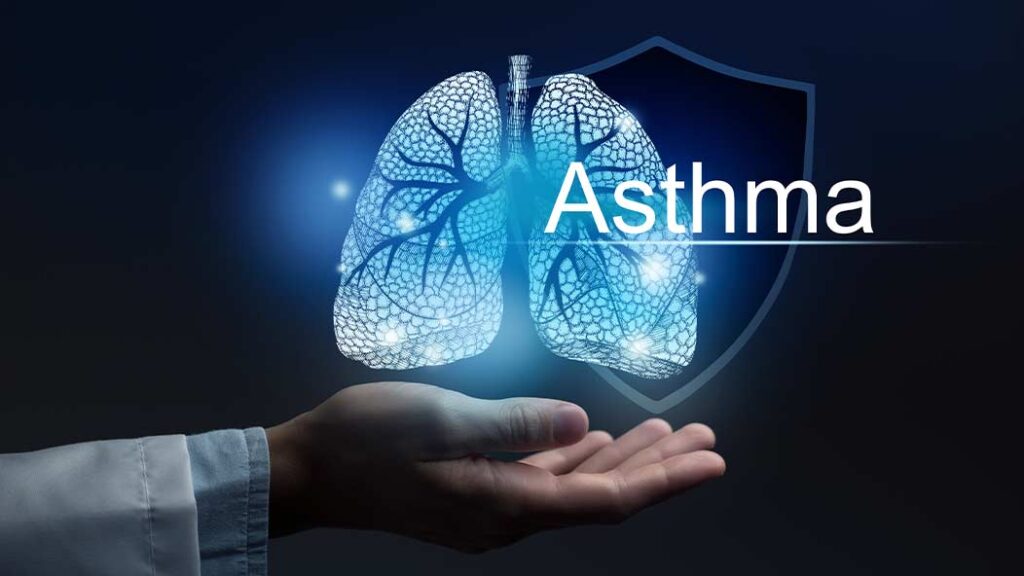 How to Manage Asthma Effectively