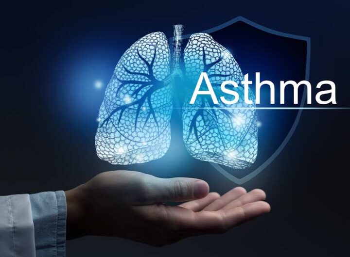 How to Manage Asthma Effectively