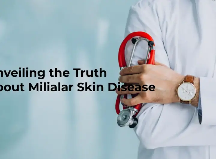 Unveiling the Truth About Milialar Skin Disease